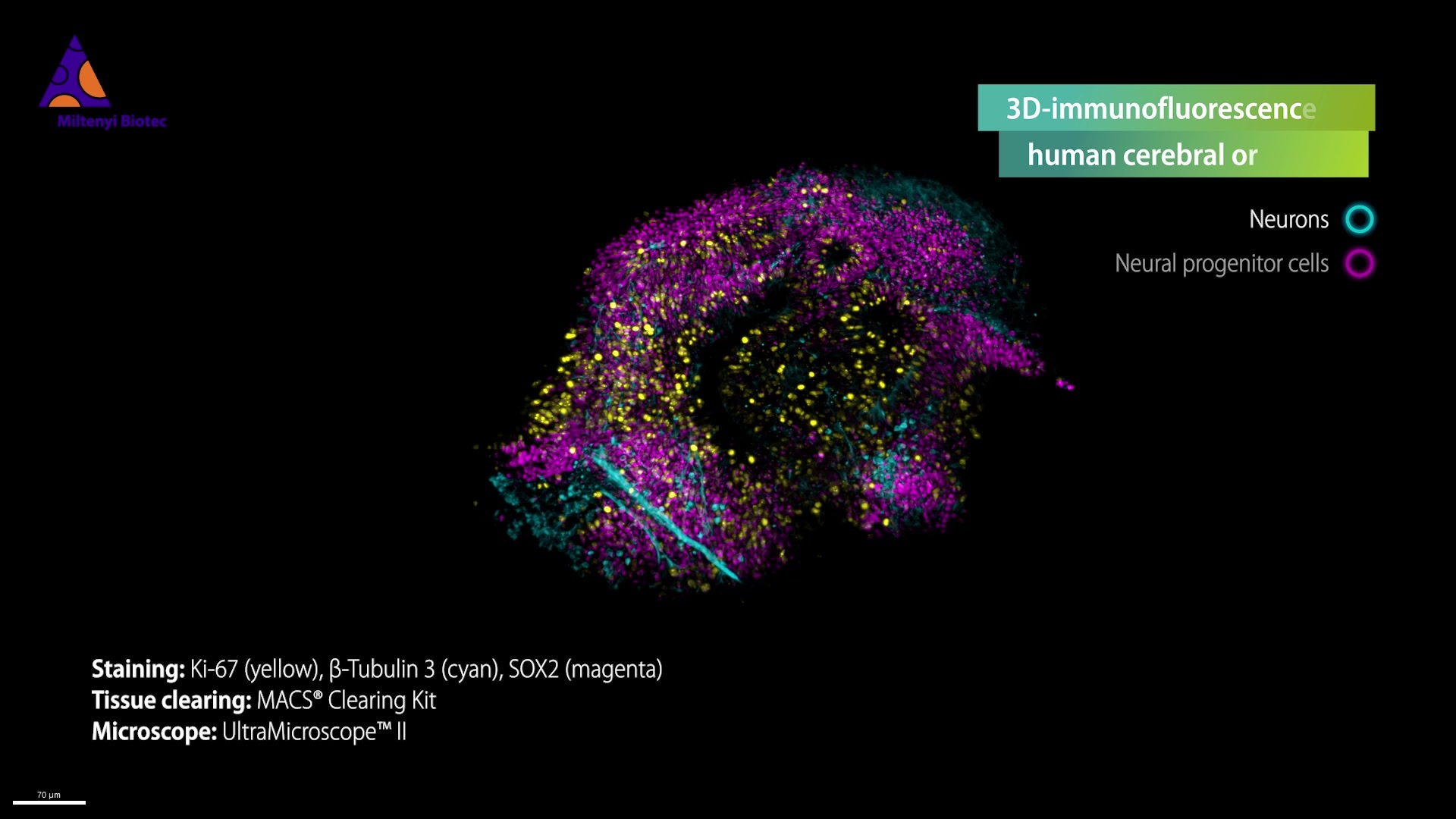 3D fluorescence microscopy workflow light sheet microscopy Miltenyi