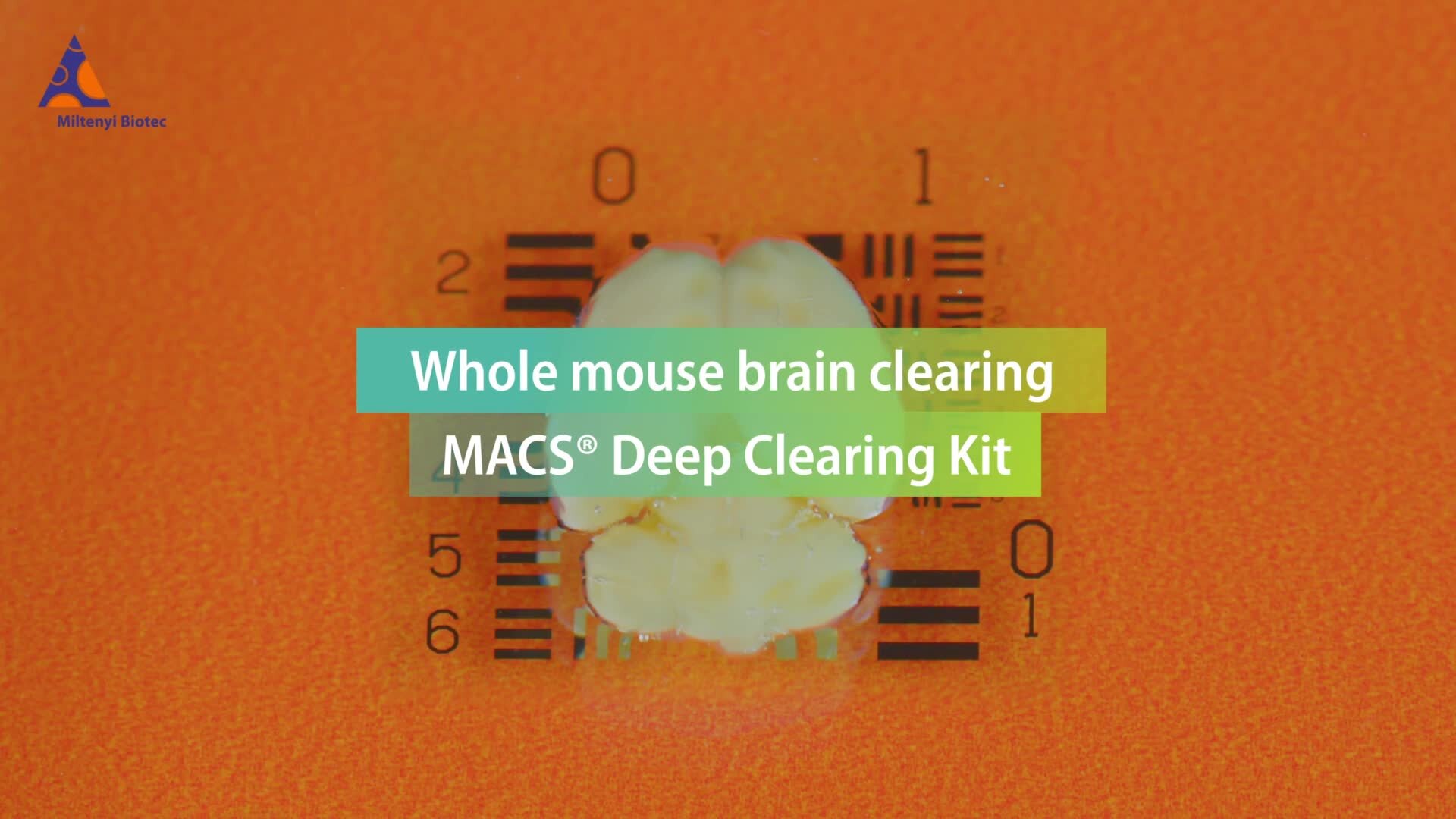 Tissue Clearing | Light Sheet Microscopy | Methods and Principles ...