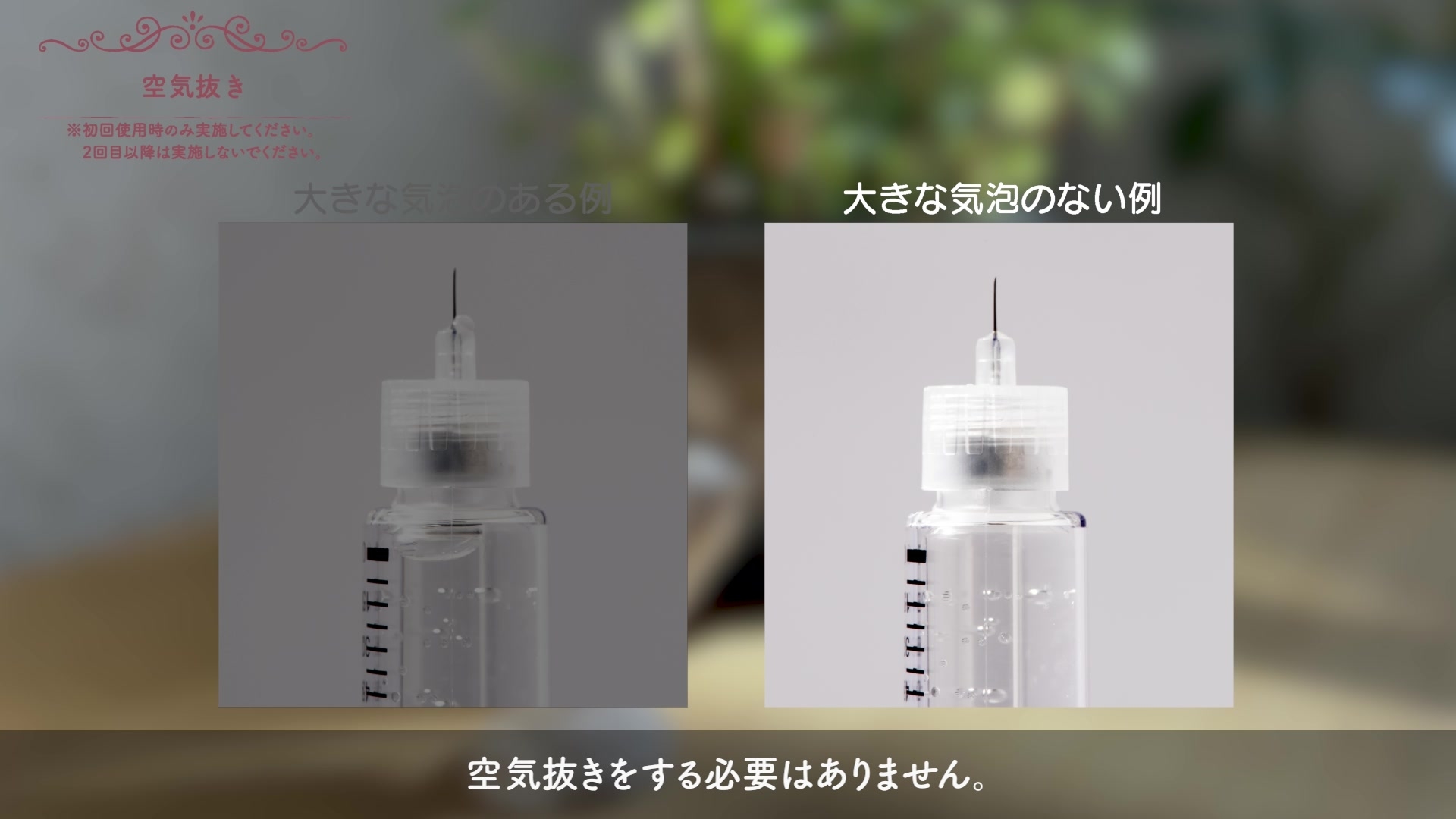 ゴナールエフ【患者向け】 | メルクバイオファーマ