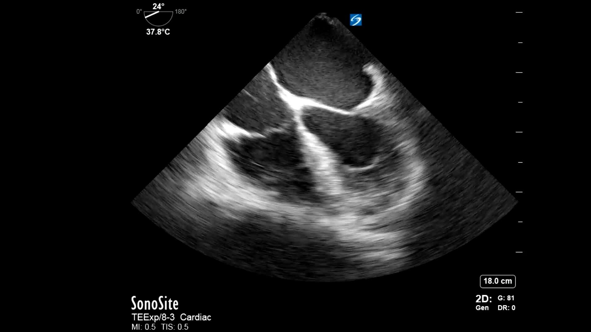 語学+参考書 Transesophageal Echocardiography A Practical Approach to Transesophageal Echocardiography