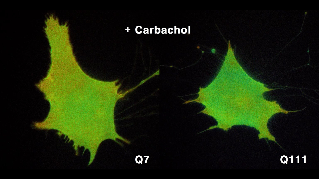 Z Decreased FAK activity and focal adhesion dynamics impair