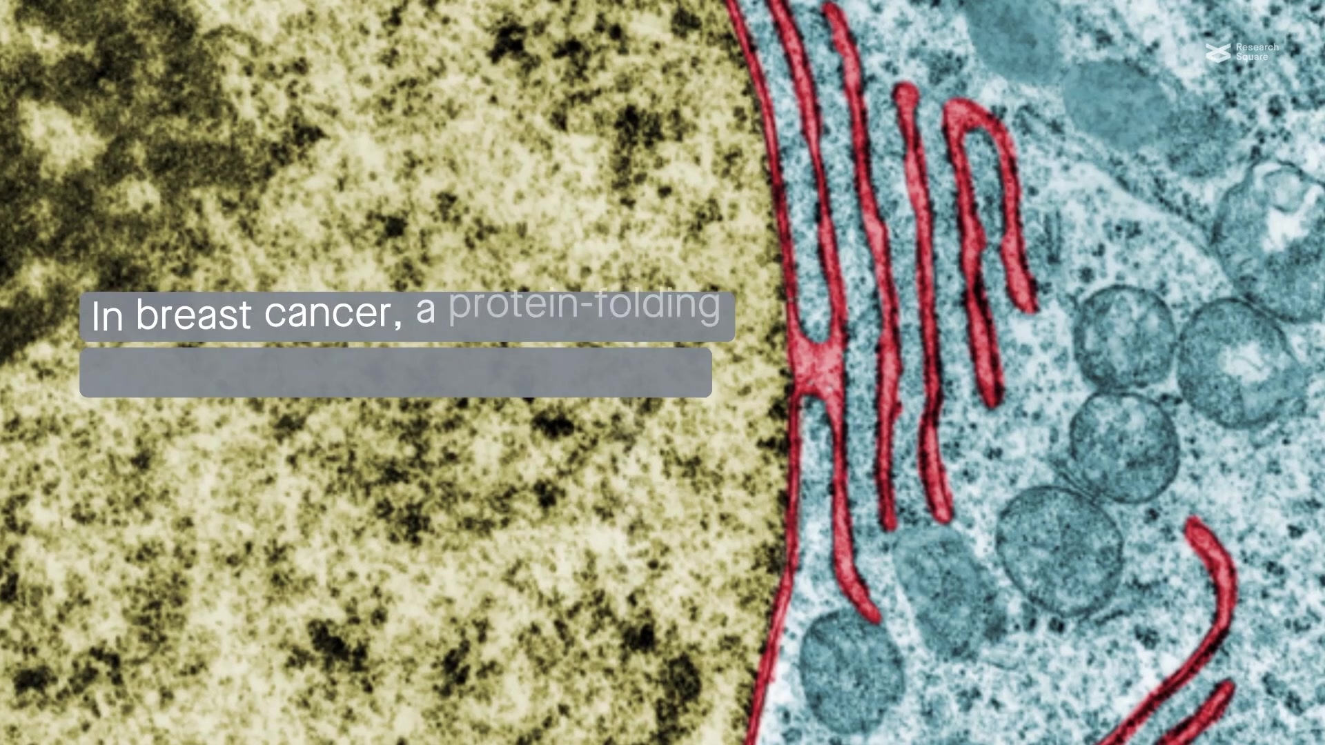 Endoplasmic Reticulum Stress Pathway, the Unfolded Protein