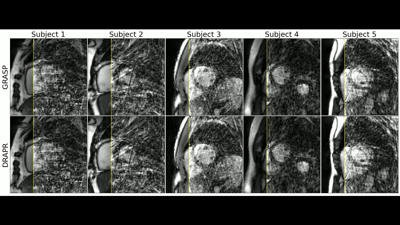An inline deep learning based free-breathing ECG-free cine