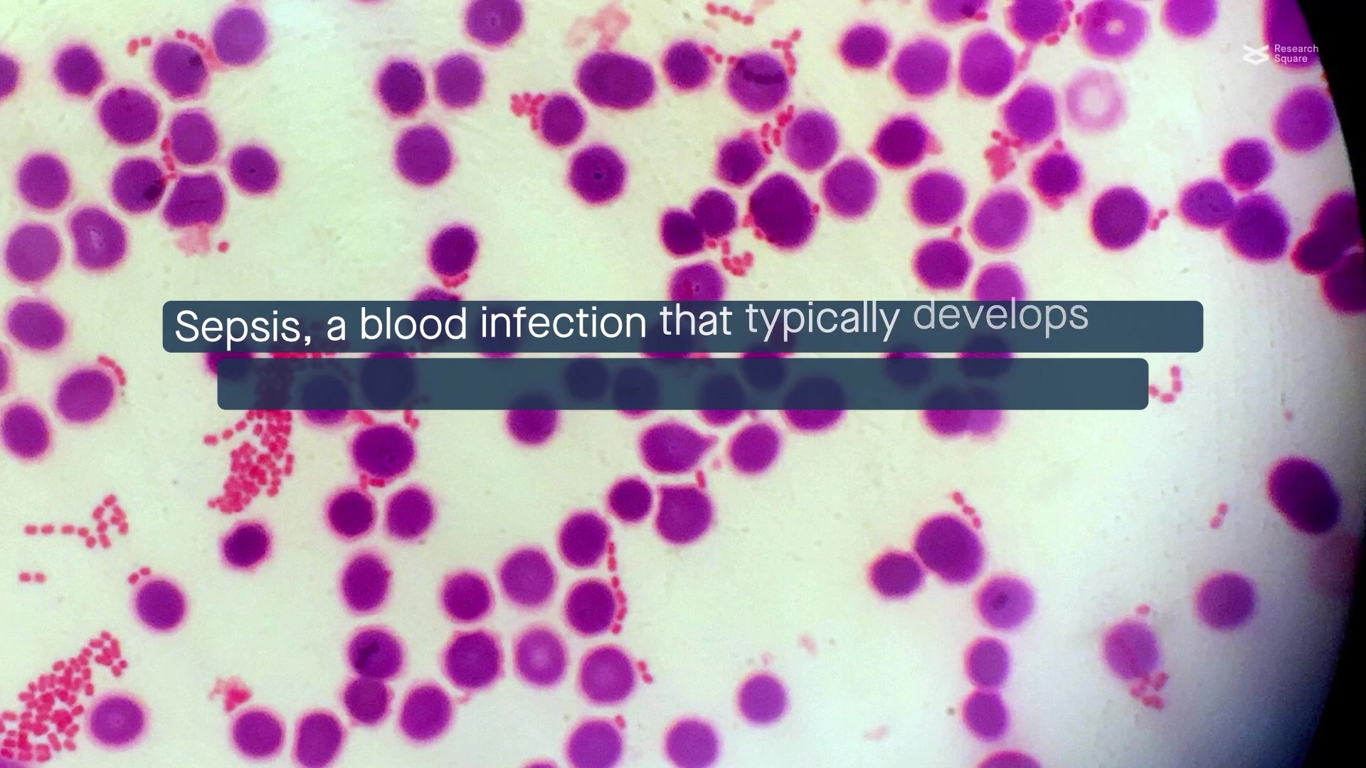 r  DIY - I made my own fuel pressure regulator!